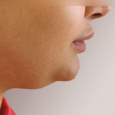 Before face treatment 1