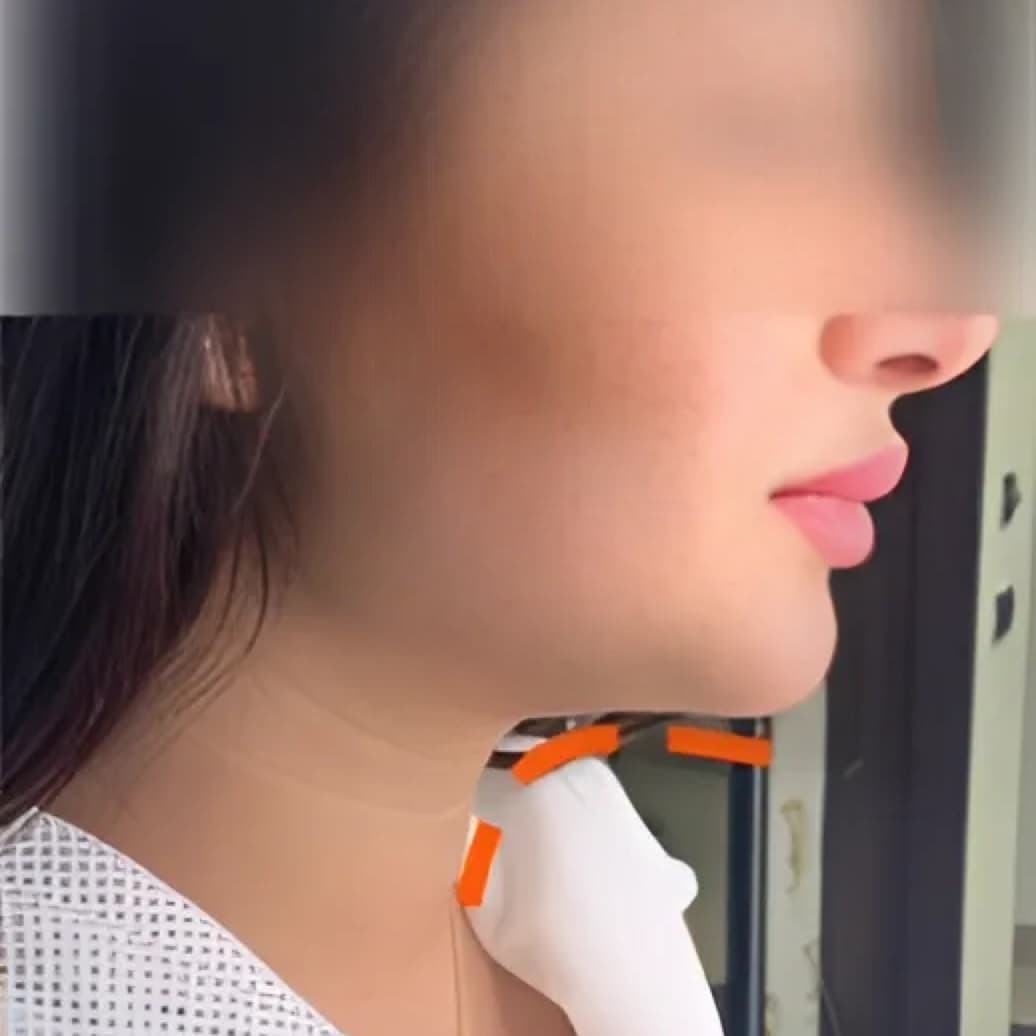 After body treatment 10