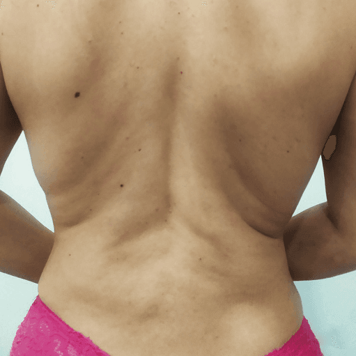 After face treatment 3