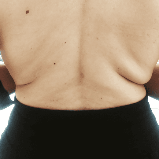 Before face treatment 3