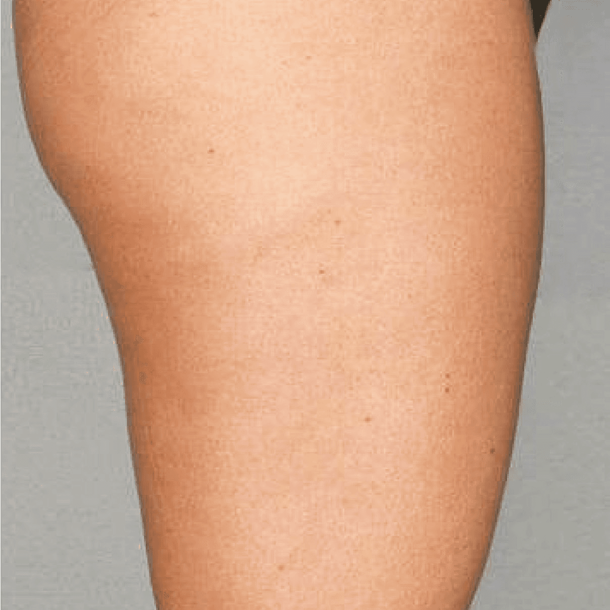 After face treatment 4