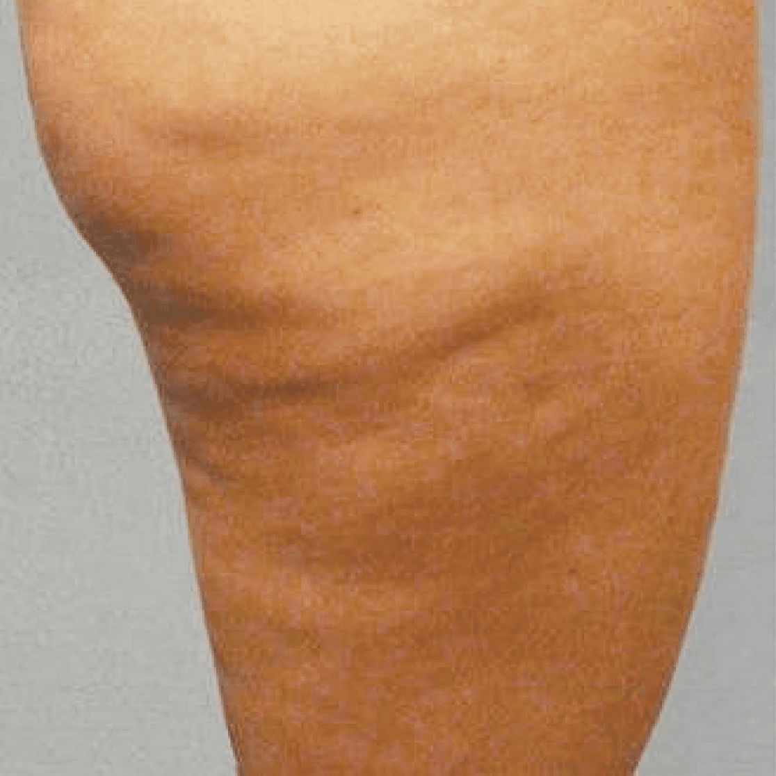 Before face treatment 4