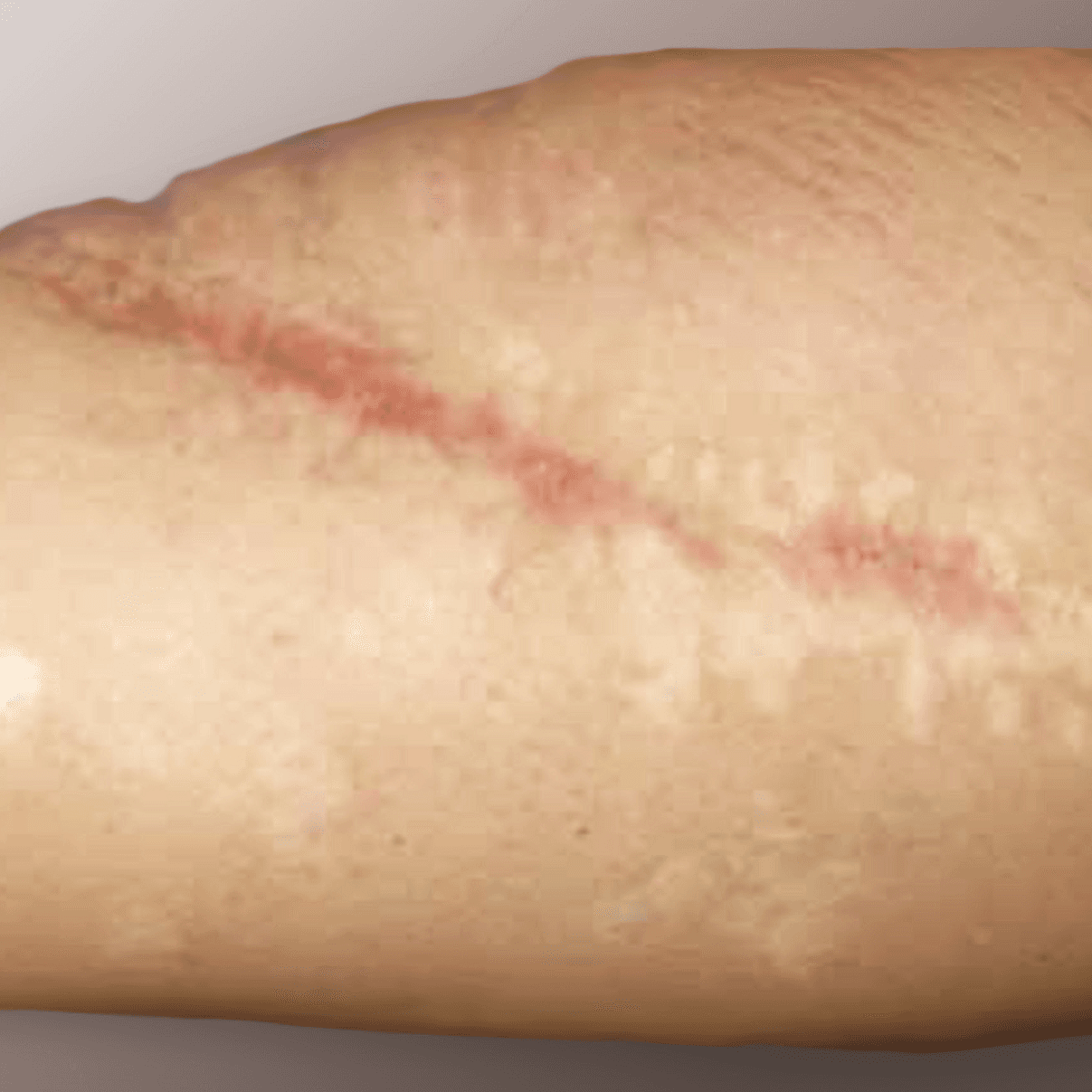 Before face treatment 5