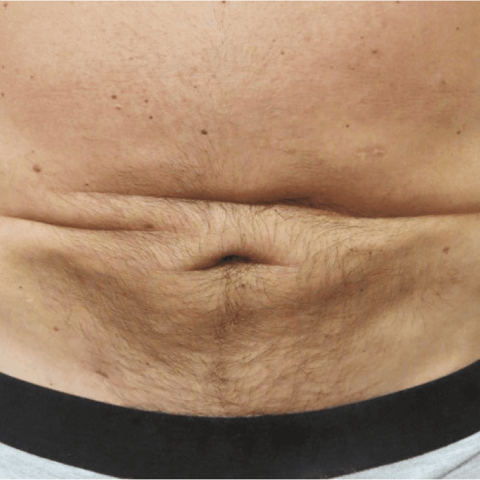 Before face treatment 6