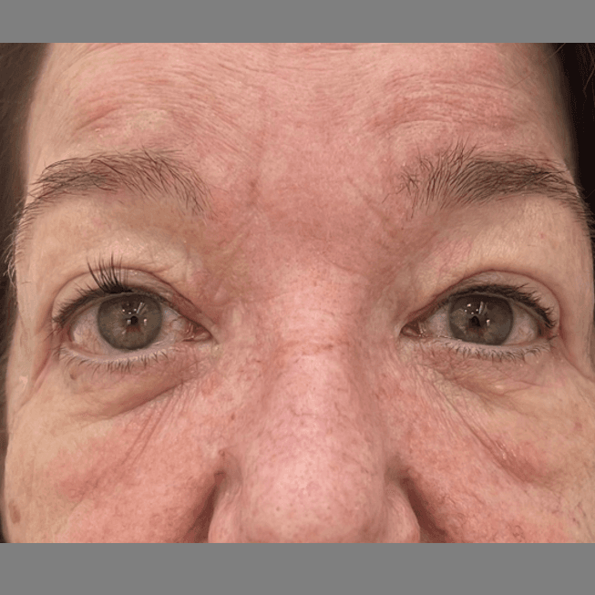 Before face treatment 1