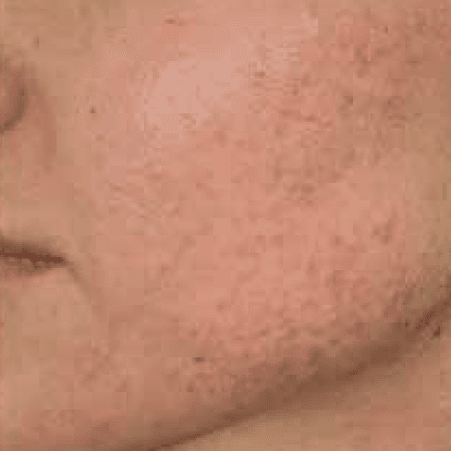 After body treatment 9