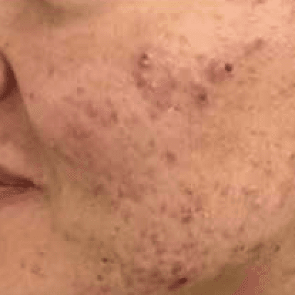 Before body treatment 9