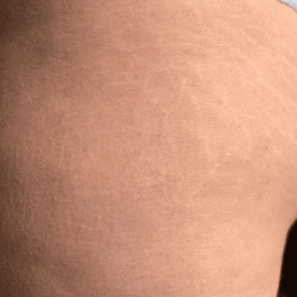 After face treatment 3