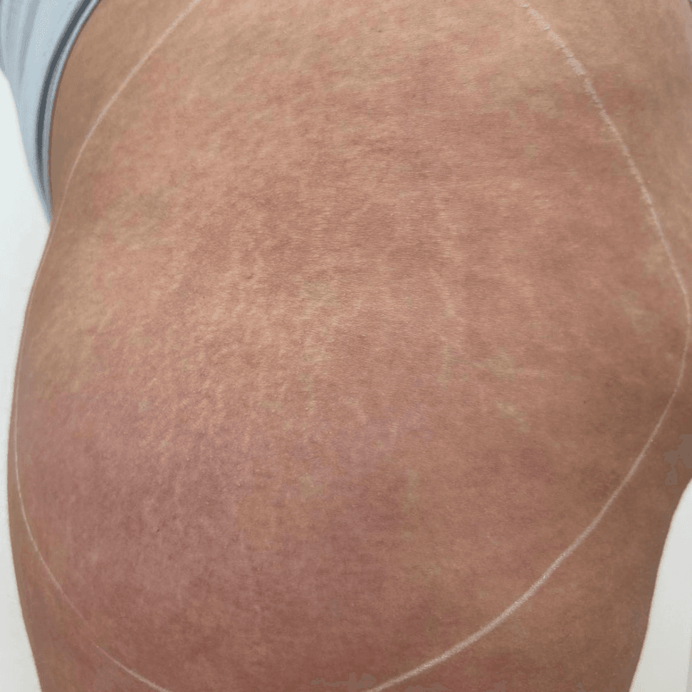 Before face treatment 3