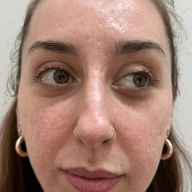 After body treatment 7