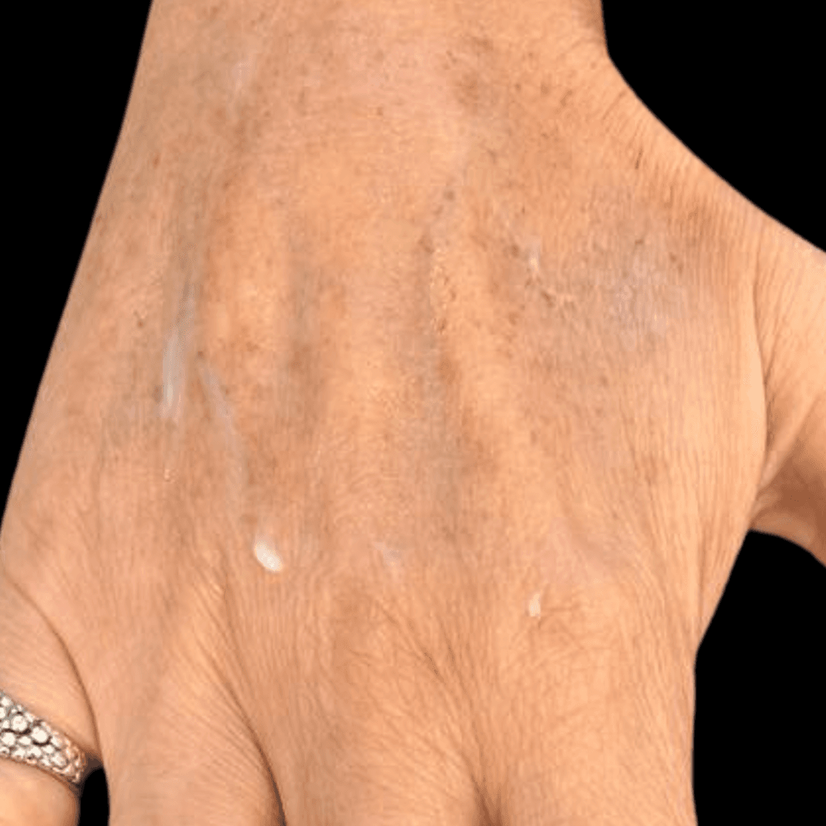 After body treatment 8