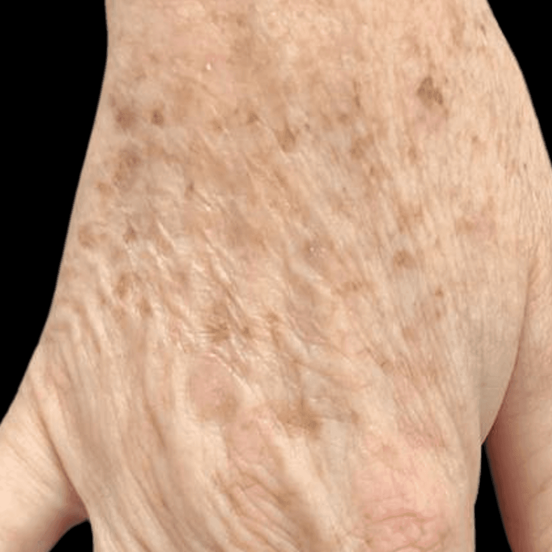 Before body treatment 8