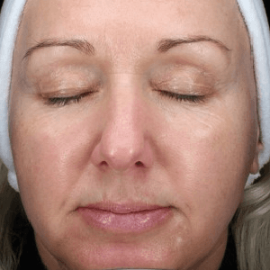 After body treatment 9